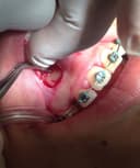 Andres Badilla Poblete